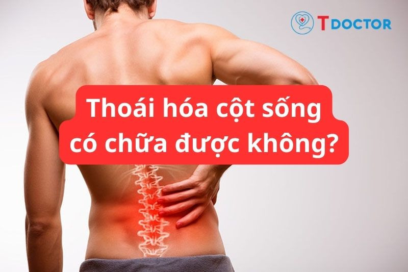 Bệnh thoái hóa cột sống có chữa được không?