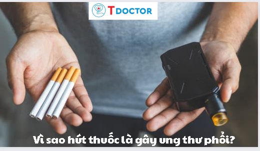 TDOCTOR.VN - Vì sao hút thuốc là gây ung thư phổi?