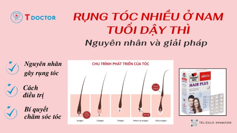 Rụng tóc nhiều ở nam tuổi dậy thì: Nguyên nhân và cách điều trị