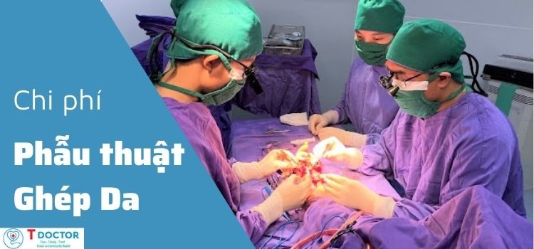 Chi phí phẫu thuật ghép da và một số lưu ý sau khi phẫu thuật