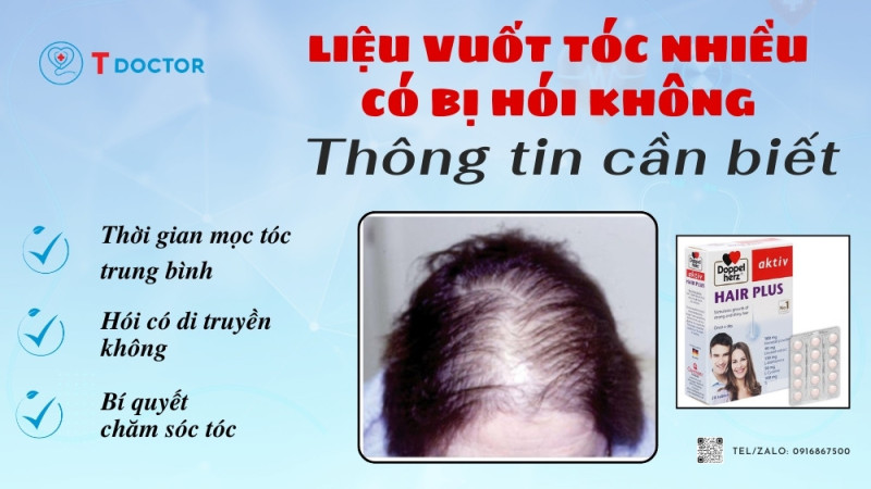 Liệu vuốt tóc nhiều có bị hói không-Thông tin cần biết