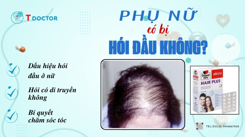 Phụ nữ có bị hói đầu không?