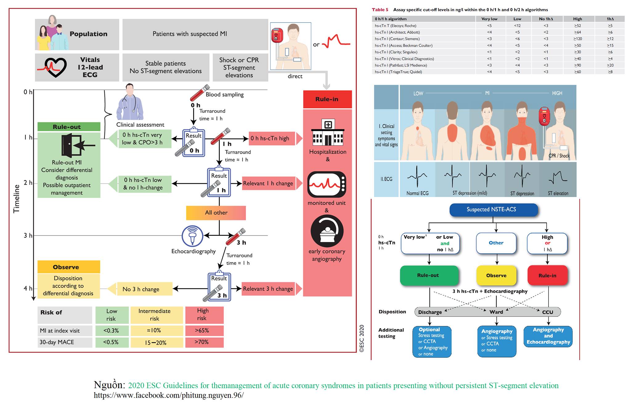 PHÂN LOẠI CHẨN ĐOÁN BỆNH NHÂN NHỒI MÁU CƠ TIM CẤP KHÔNG ST CHÊNH LÊN THEO GUIDELINE ESC 2020