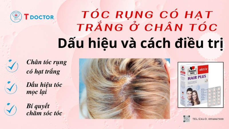 Tóc rụng có hạt trắng ở chân tóc. Dấu hiệu và cách điều trị